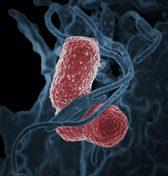 Klebsiella bacteria, NIAID